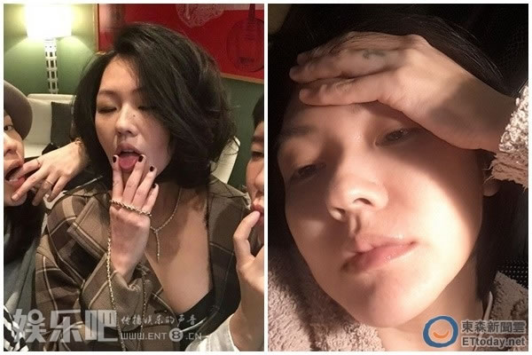 \