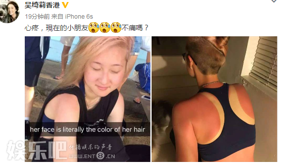 \