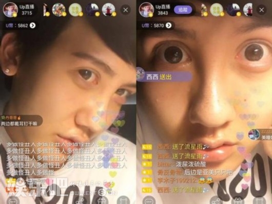“蛇精男”1天打14针玻尿酸炫耀：我很像芭比